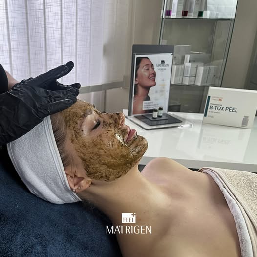 Matrigen B-Tox Peel Koreai hámlasztás